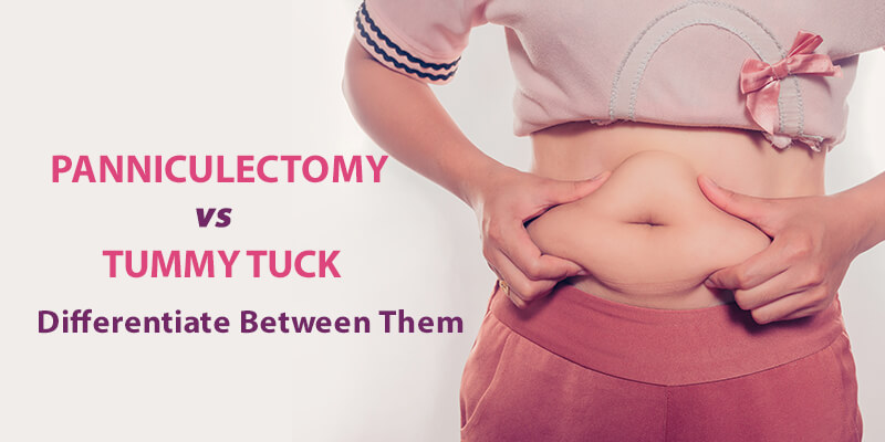 tummy tuck belly button healing